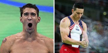 拔火罐吃瓜,夏日养生新风尚